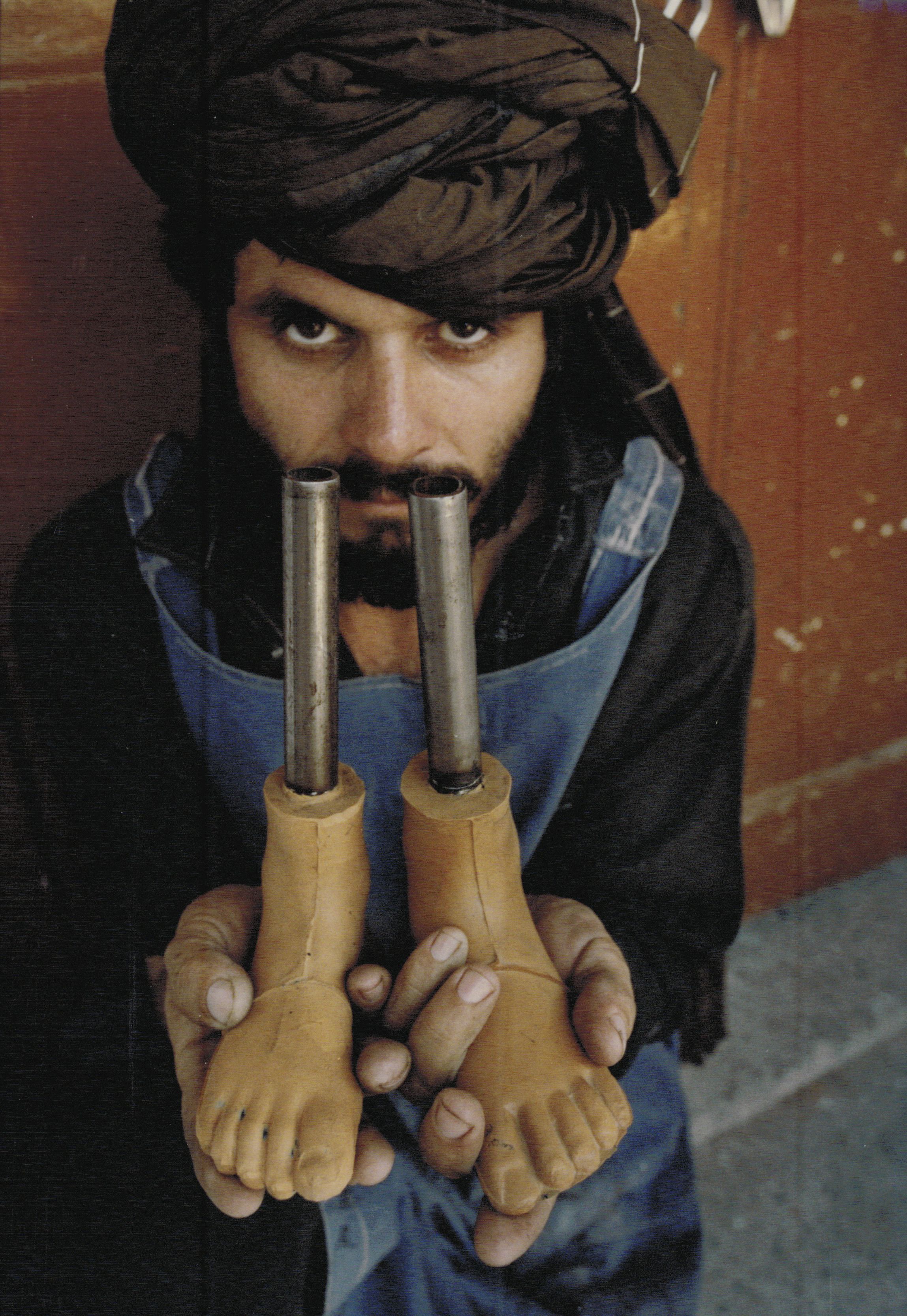 A foot technician with artifical feet made for child victims 