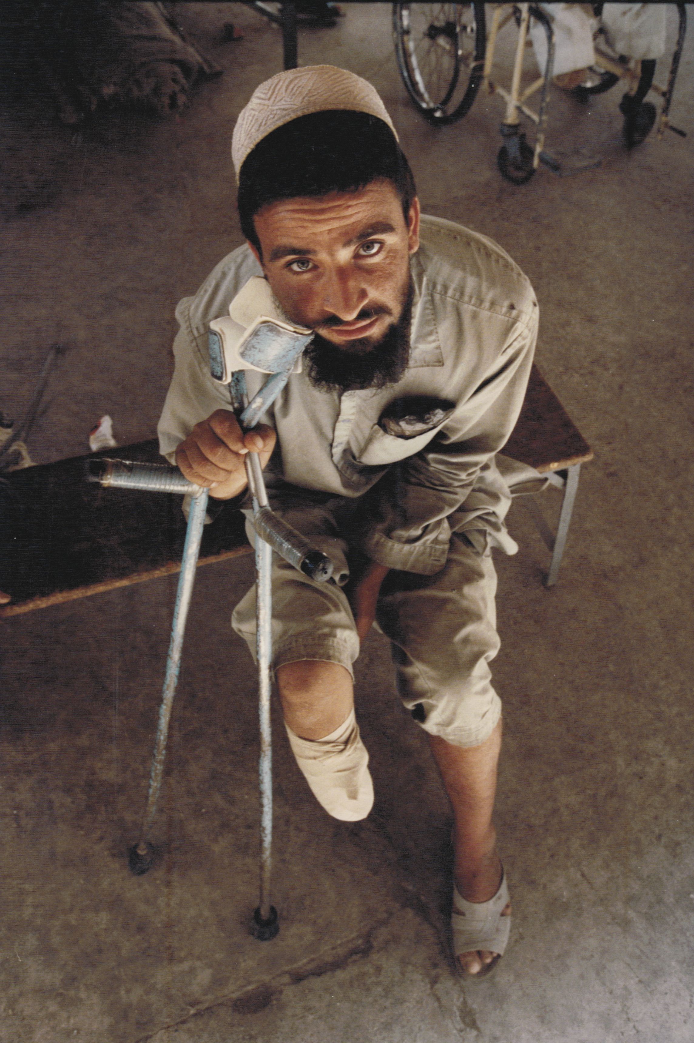 An Afghani mine victim